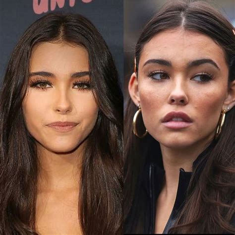 madison beer plastic surgery|Madison Beer Plastic Surgery: Quotes, Before, After。